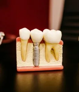 Como a saúde bucal influencia a autoestima e a forma como nos relacionamos